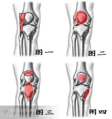 【户外常识篇】你的膝盖是否还健康?