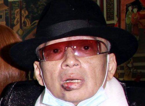 高凌风患癌唇肿发紫吐血块 21岁女儿首次见爹